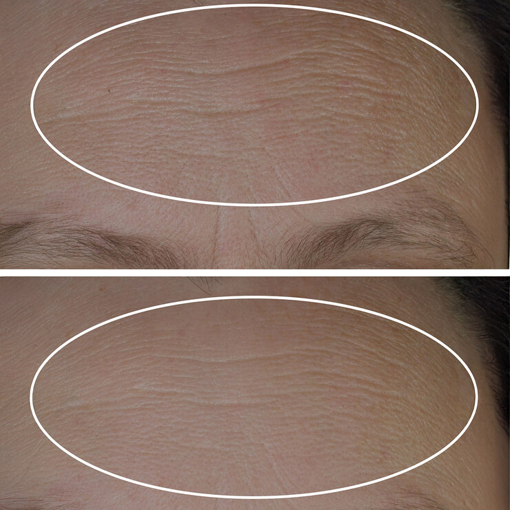 StriVectin Sérum Rellenador de Líneas Peptide Plump 2 pzas StriVectin Sérum Rellenador de Líneas Peptide Plump 2 pzas
