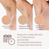 Philips Lumea Depiladora Series 8000 Philips Lumea Depiladora Series 8000